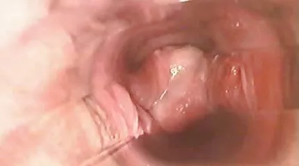 Grote lul beukende chick met braces poldertube lesbisch