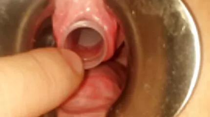 Tijdens de menstruatie laat het meisje haar hollandse sex films vriendin neuken